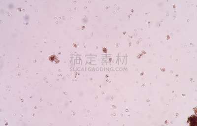 红细胞,生物学,健康保健,生物科技,科学实验,技术,图像,无人