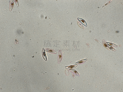 硅藻属,藻类,在下面,放大效果,生物学,生物燃料,显微镜,退化单眼,淡水,海洋生命