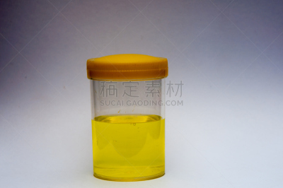 特写,尿检样品,健康保健,水平画幅,科学实验,标签,实验室,肾,容器