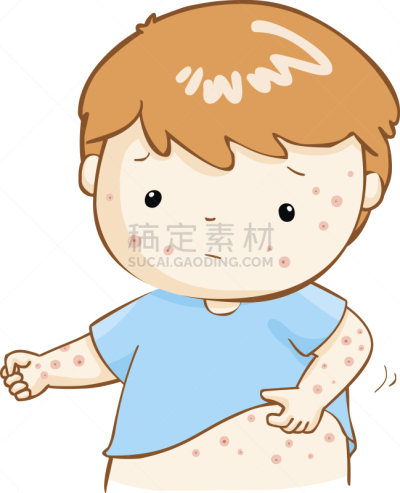 男孩,矢量,皮疹,动物躯干,乳突,水痘,湿疹,过敏药,疙瘩,炎症