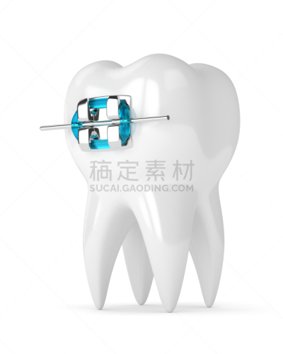 支柱,牙齿,三维图形,垂直画幅,美,绘画插图,颌骨,干净,线绳,金属丝