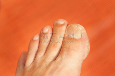 指甲,足,手指,美容用具,特写,咬碎,咬指甲,疣,咬一口,趾甲
