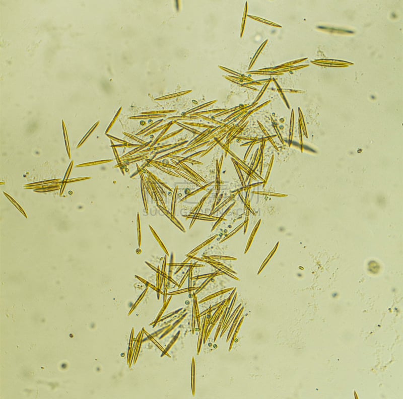 硅藻属,微生物,硅藻的细胞膜,单细胞生物,大规模的放大,显微图片,叶绿体,植物细胞,显微镜,水平画幅