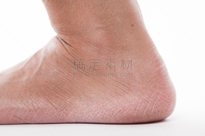 足,皮肤,女性,四肢,水平画幅,古老的,腿,干的,干净