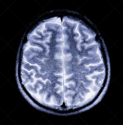 磁共振成象扫描,脑,垂直画幅,头痛,肺叶,科学,生物学,图像,特写,男性