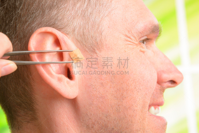 耳针疗法,艾灸,中医,针灸,人的耳朵,替代疗法,辅导讲座,水平画幅,特写,专业人员