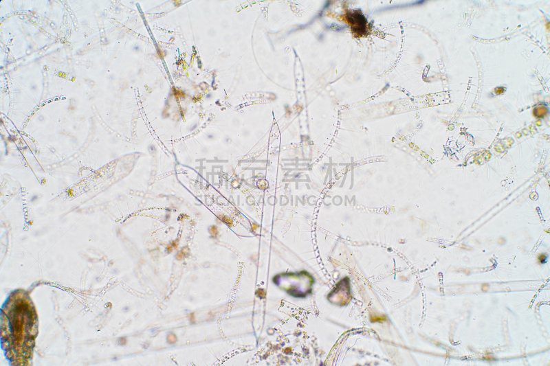 显微镜,水生动植物,海洋,浮游生物,风景,在下面,生物学,淡水,暗色,自然界的状态