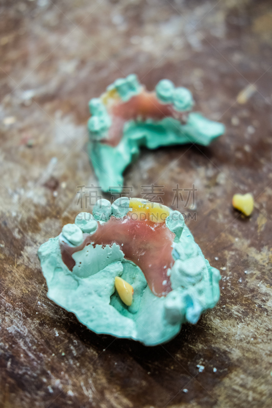 假牙,概念和主题,垂直画幅,人造的,牙冠,假肢,二叶,健康保健,塑胶
