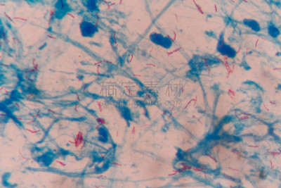 结核杆菌,显微镜,梭菌,分枝杆菌,水平画幅,小的,微生物学,无人,科学