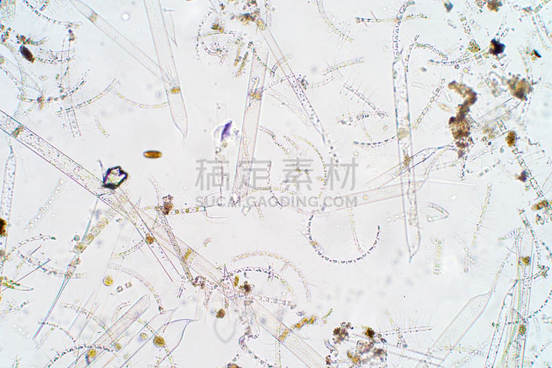 显微镜,水生动植物,海洋,浮游生物,在下面,风景,生物学,淡水,暗色,自然界的状态