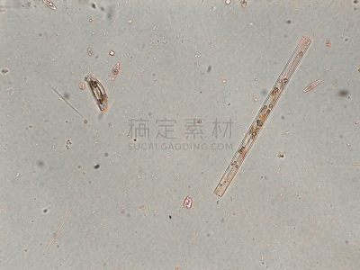 硅藻属,放大效果,在下面,生物学,生物燃料,显微镜,退化单眼,淡水,海洋生命,环境