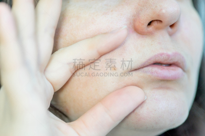 女人,痣,皮肤,健康保健,良性肿瘤,皮肤病学,病人,人