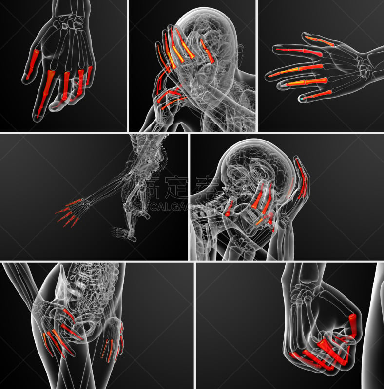 趾骨,三维图形,手,人,绘画插图,骨关节炎,肌腱,风湿病,骨质疏松症,垂直画幅