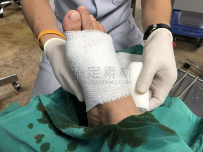 足,医疗流程,成年的,表皮,手指,四肢,腿