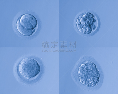 卵,人类兹戈特,人工授精,干细胞,孕检,显微图片,染色体,显微镜,人造的