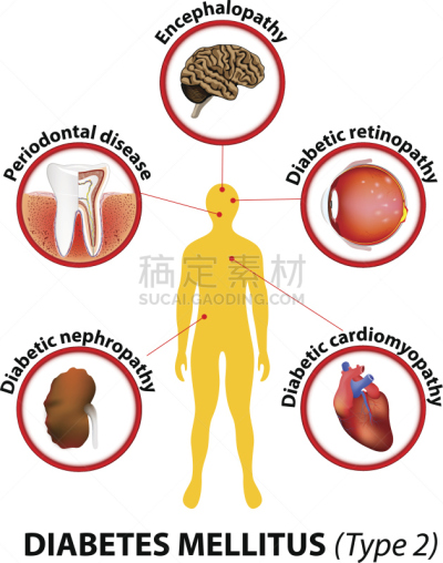 糖尿病,文字,长发,健康保健,新陈代谢,视网膜病,葡萄糖,小的,多糖症,人的眼睛