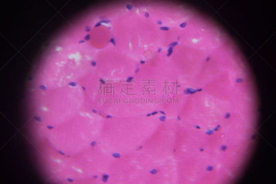 人的眼睛,放大效果,在下面,睫状肌,前房,视网膜,眼球,虹膜,视力测验,神经系统