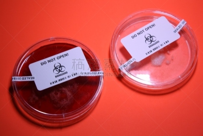 生物学,血琼脂,微生物学,健康保健,药,生物科技,科学实验,加拿大