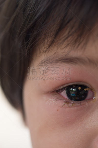 人的眼睛,垂直画幅,球,身体受伤,眼睑,科学实验,化妆用品,特写,泰国