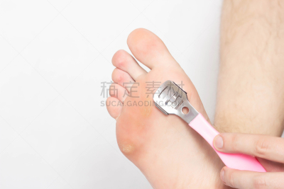 皮肤病学,设备用品,男人,干的,足,特写,制造机器,个性,药,移开