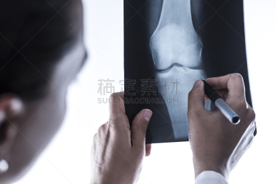 膝,x光,放射科专家,专门技术,健康保健,专业人员,科技,无法辨认的人,过肩视角,一个人