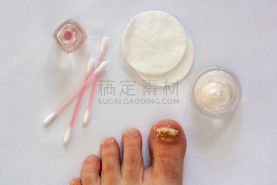 真菌,指甲,趾甲,线,花蕾,防护品,奶油,健康保健,部分,化妆棉