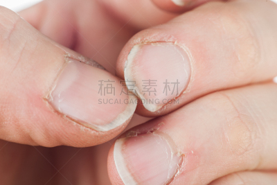白色背景,成年的,指甲,男性,损坏的,分离着色,平衡折角灯,波兰,坏掉的,撕破的