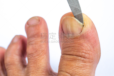 部分,肮脏的,女人,脚 ,白色背景,卫生,女性,趾甲,特写