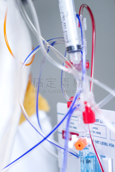 静脉滴注,加护病房,顺序,气管切开管,脓毒症,（血管、淋巴管、神经等的）丛,电缆,垂直画幅,装管,无人