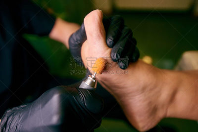 药,足,门诊部,横截面,专业人员,职业运动员,肮脏的,发型屋,甲真菌病