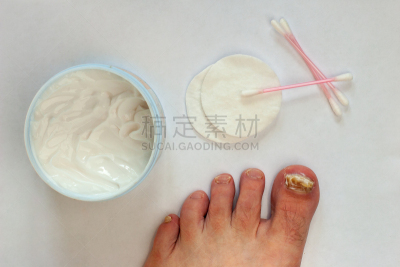真菌,指甲,趾甲,奶油,防护品,线,花蕾,健康保健,部分,化妆棉