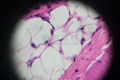 人的眼睛,放大效果,在下面,睫状肌,前房,视网膜,眼球,虹膜,视力测验,神经系统