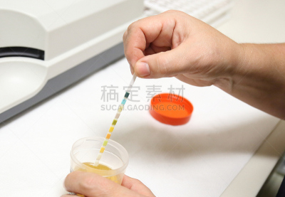 尿检样品,健康保健,护士,部分,医药职业,医疗技术设备,医疗流程,遗传研究,一个人,医疗器械