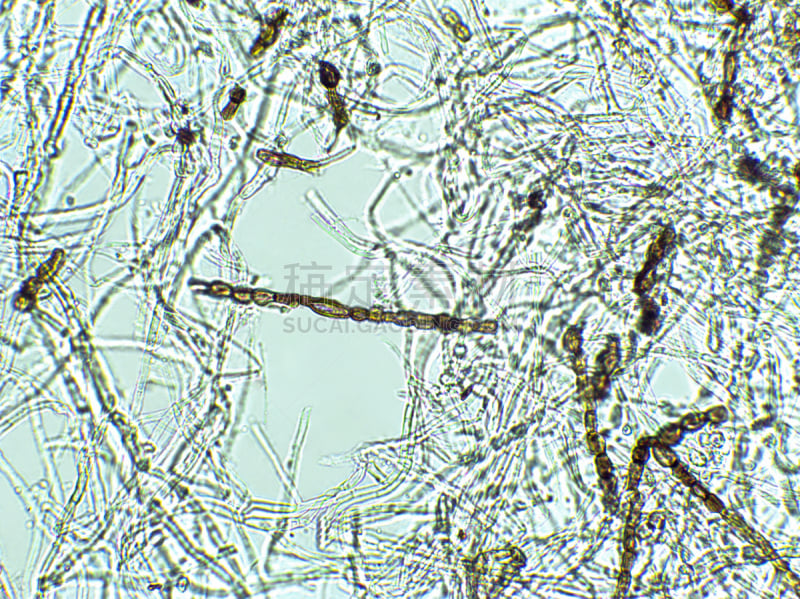 藻类,放大效果,在下面,生物燃料,显微镜,科学实验,生物课,细胞,池塘,细胞核