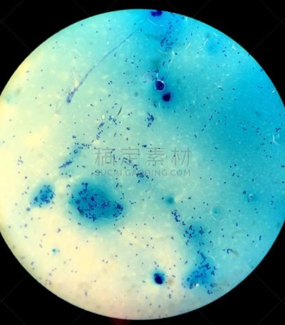 细菌,脑脊髓液,显微镜,看,圆形,脑膜炎,小的,危险