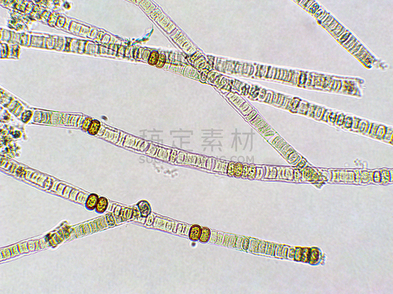 藻类,在下面,放大效果,信笺针,生物燃料,显微镜,科学实验,生物课,细胞,池塘