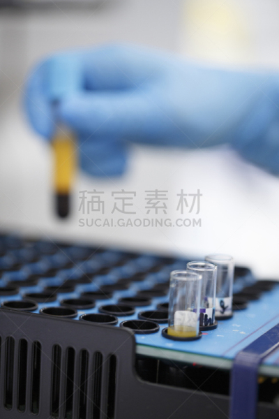 手,艾滋病,健康保健,特写,病毒,脱氧核糖核酸,现代,实验室,医疗器械,医学样本