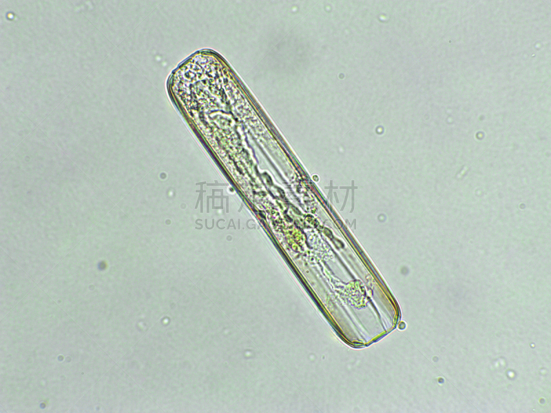 藻类,在下面,放大效果,生物燃料,显微镜,科学实验,生物课,细胞,池塘,细胞核