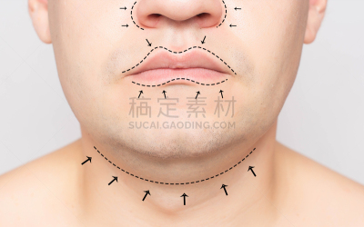 男人,概念,整形手术,双下巴,修改系列,疤,距离标记,人的脸部,搬家卡车,整形