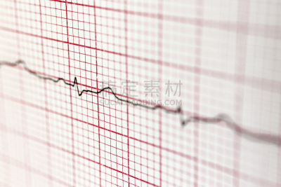 背景,接力赛,微距,心电图,立陶宛共和国,健康保健,脉搏图,图表,药,频率
