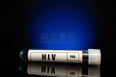 艾滋病,艾滋病病毒,医学样本,管子,特写,艾滋病检测,药,纳米技术,科学实验,医疗流程