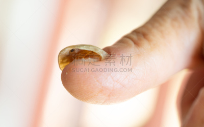指甲,健康保健,药,皮肤病学,肮脏的,真菌,问题,不舒服