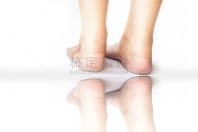 腿,破碎的,足,白色,女性,分离着色,人,踮着脚尖,皮炎,卫生