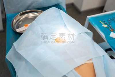 病人,痣,特写,住房,搬家卡车,背面视角,卫生,手术,覆盖