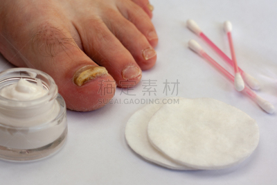 真菌,趾甲,奶油,花蕾,线,广口瓶,防护品,健康保健,部分,化妆棉